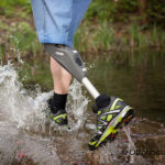 Genium Knee (Ottobock)